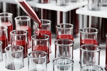 Scientist examining radiopharmaceutical compounds for cancer therapy in high-tech oncology lab